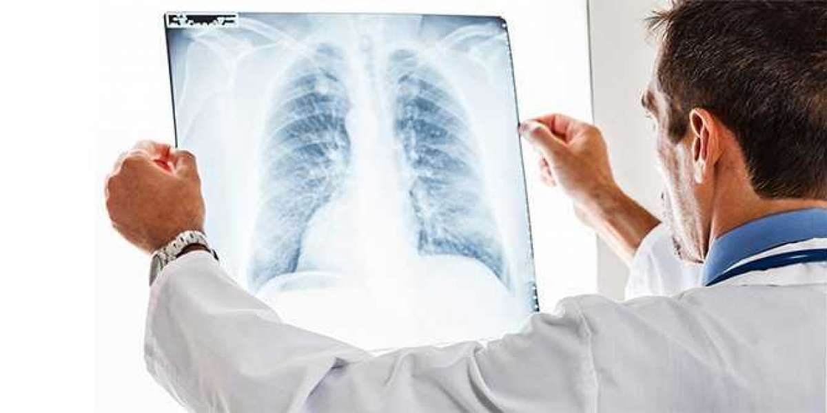 Akciğer İçin Hangi Doktora Gidilir? Göğüs Hastalıklar Neye Bakar?