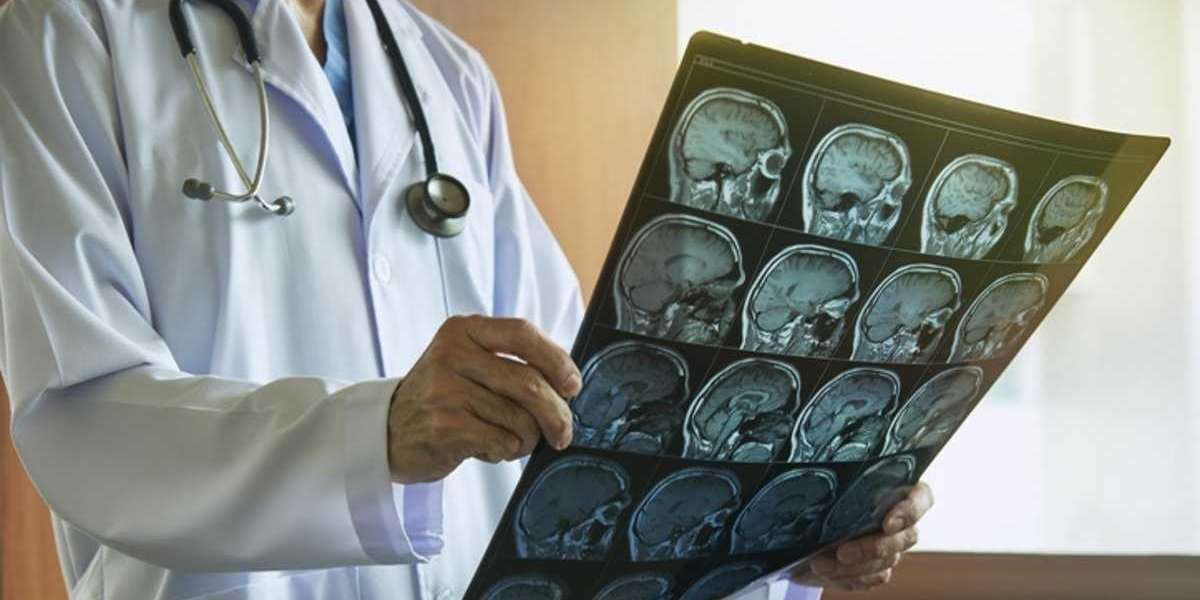 Beyin Cerrahi Neye Bakar? Beyin Cerrahi Hangi Hastalıklara Bakar?