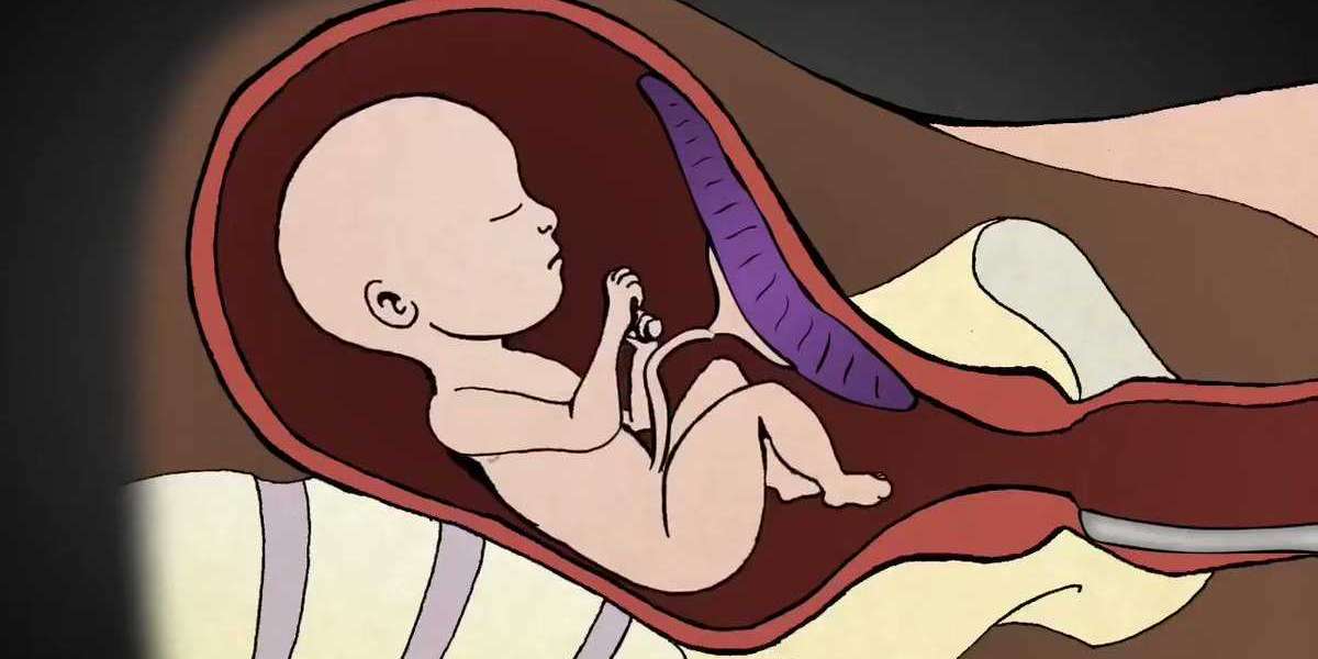 Kürtaj Sonrası Nelere Dikkat Edilmeli? Kürtaj Sonrası Neler Olur?